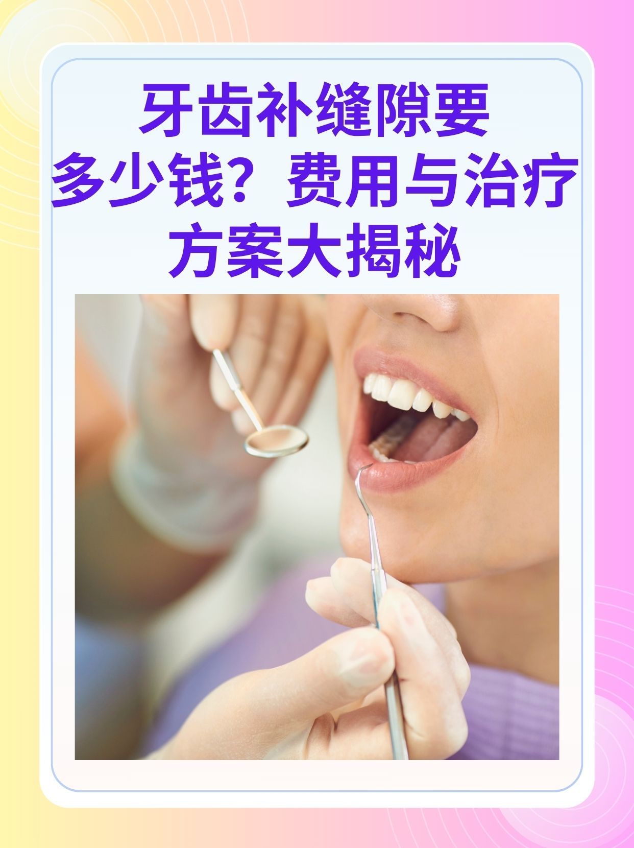 钦州补牙医保可以报销吗(补牙医保可以报销吗 哪些可以报销呢)